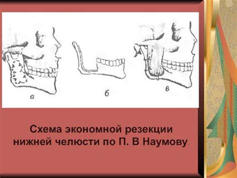 Выбор анатомической структуры лица