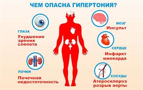 Высокое давление: причины и симптомы тошноты