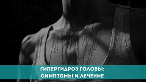 Гипергидроз и перспирация