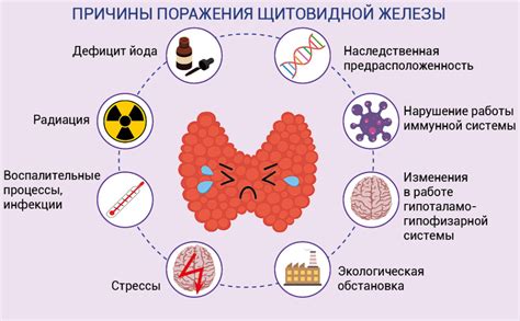 Гипотиреоз: причины давления от недостаточной работы щитовидной железы