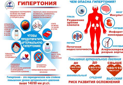 Главный образ - повышенное волнение