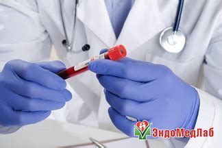 Гормональное исследование