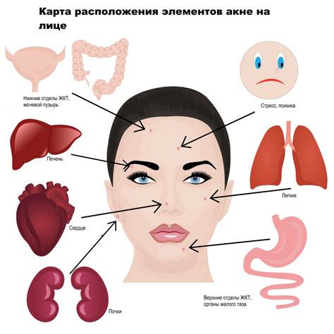 Гормональный дисбаланс как основная причина прыщей на левой щеке