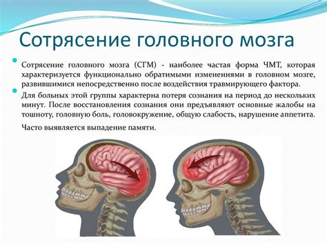Диагностика и лечение сотрясения головы: какие методы существуют
