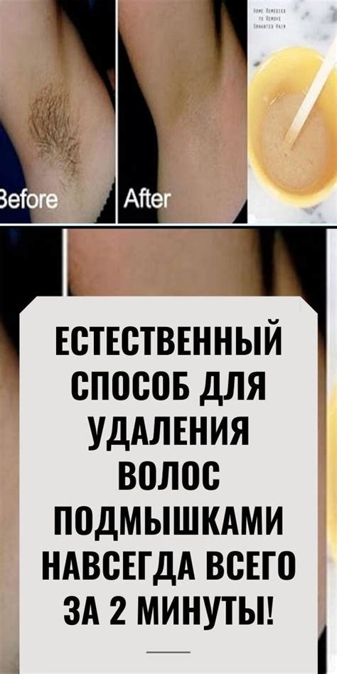 Долговременное удаление волос без воска в домашних условиях