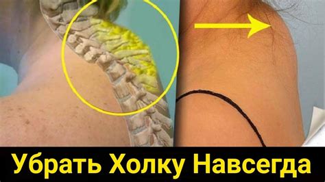 Домашние методы предотвращения шишки на шее