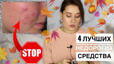 Домашние средства от прыщей на левой щеке