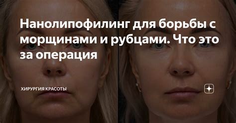 Естественные ингредиенты для борьбы с рубцами