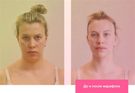 Естественные способы для выделения скул