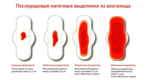 Живот после родов: преимущества и риски хирургических методов