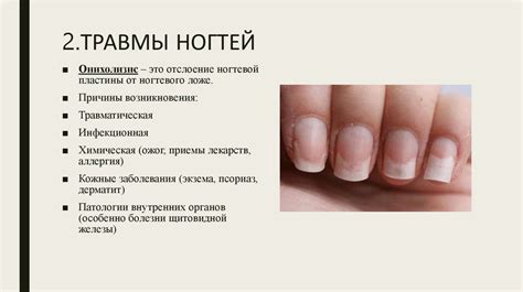 Заболевания ногтей и кожи