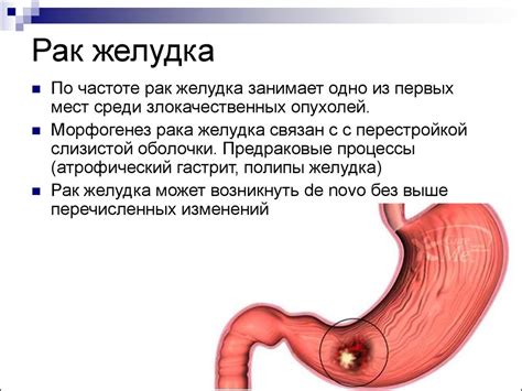 Заболевания пищевода и желудка