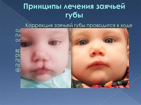 Заливка заячьей губы цветом