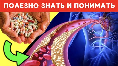 Здоровье сосудов - залог общего благополучия