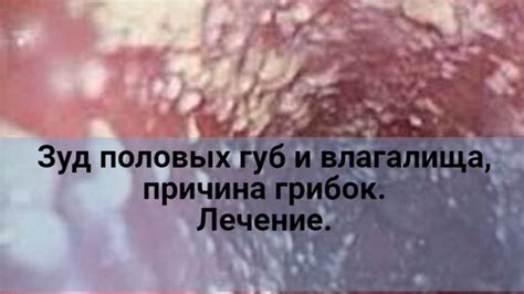 Зуд и раздражение насальных полостей