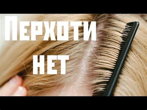 Избавляемся от перхоти