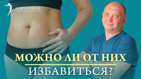 Избавляемся от растянутой кожи на животе: методы и регенерация