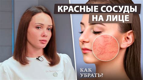 Избегайте причин постоянного покраснения лица