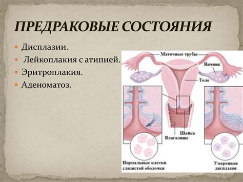 Изменения слизи шейки матки