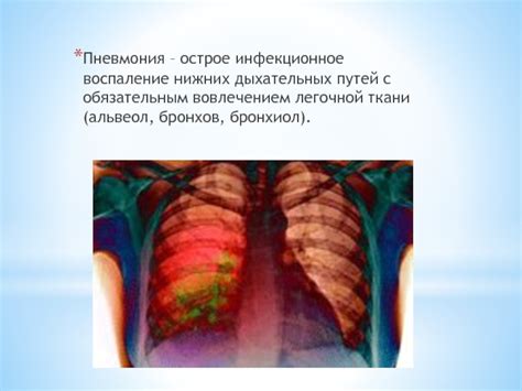 Инфекционное воспаление