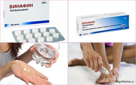 Использование медицинской мази