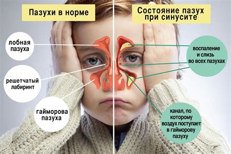 Использование природных препаратов для увеличения носа у ребенка
