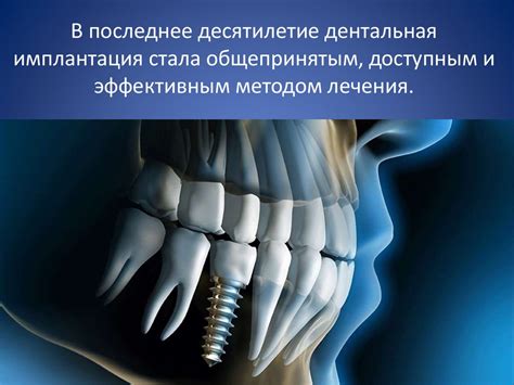 Использование технологических имплантатов: получение преимуществ
