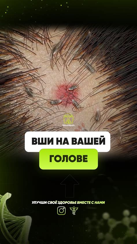 Используйте специальные хранители