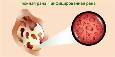 Источники воспаления и инфекции как причины расхождения шва