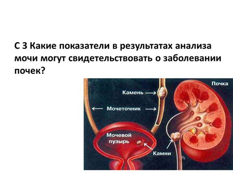 Какие еще оттенки мочи могут свидетельствовать о проблемах