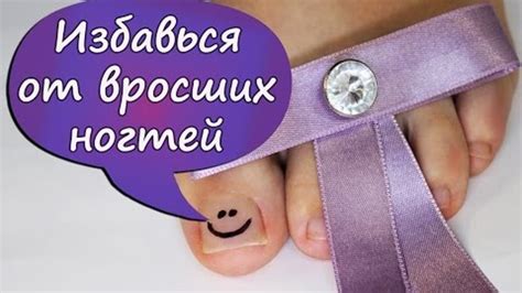 Как избавиться от врастающего ногтя дома: эффективные методы