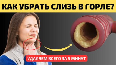 Как избавиться от слизи в горле: эффективные способы