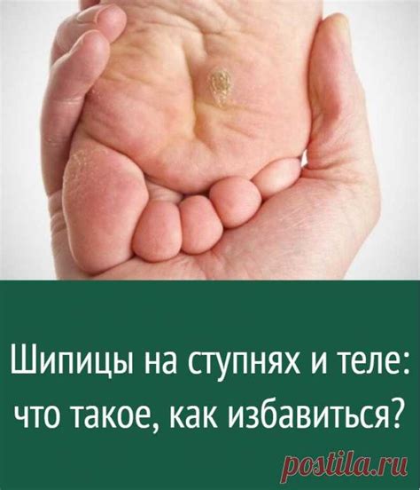 Как избавиться от шипицы у ребенка при помощи народных средств