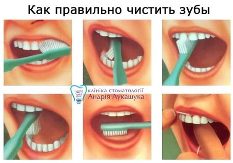 Как использовать йод для ухода за зубами