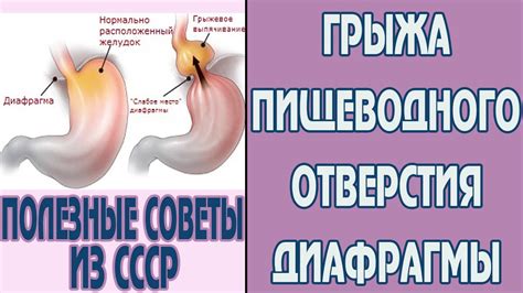 Как лечить полезные советы