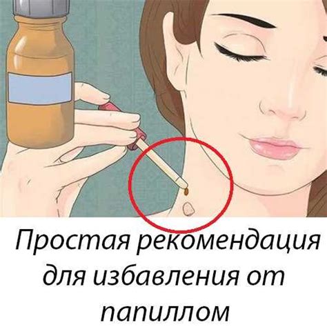 Как навсегда избавиться от типунов: советы и рекомендации