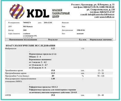Как настроить КДЛ: полезные советы
