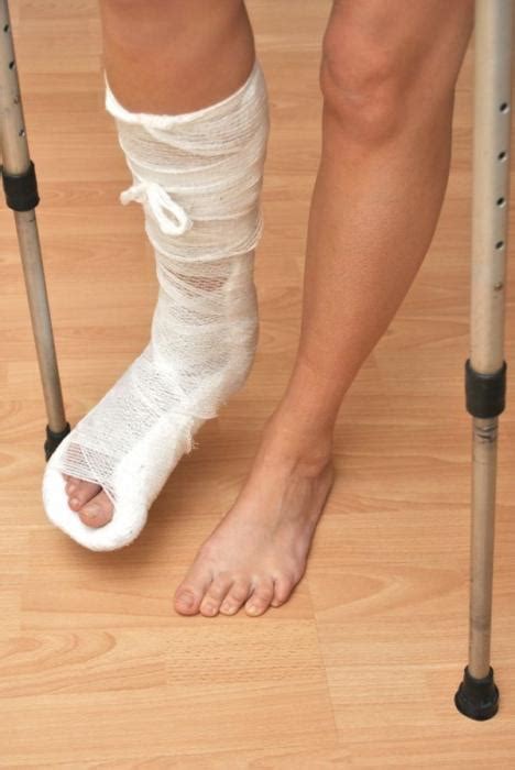 Как определить сломанную ногу: симптомы и признаки