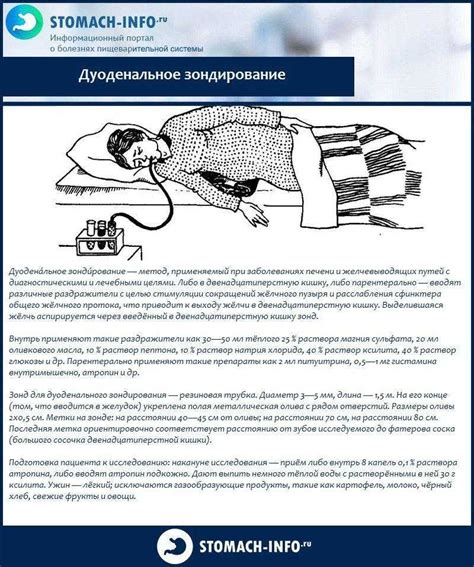 Как подготовиться к дуоденальному зондированию: полезные инструкции и правила