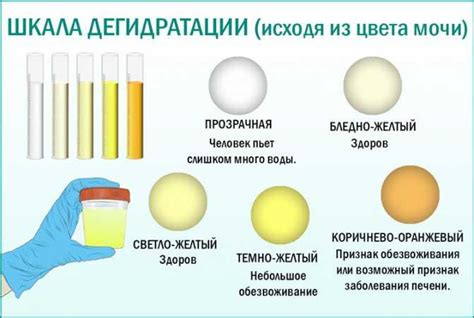 Как правильно реагировать на изменение цвета мочи