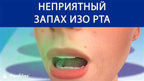 Как предотвратить неприятный запах изо рта у подростков