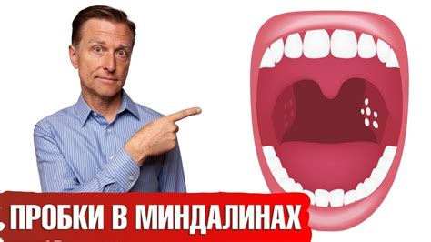 Как предотвратить появление гнойных образований