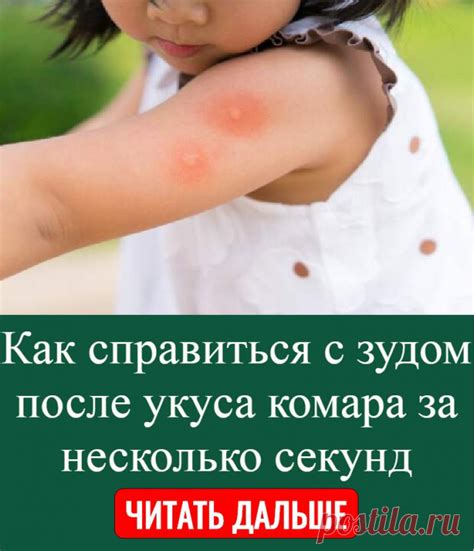 Как предотвратить чесотку после укуса комара