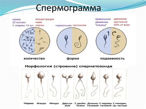 Как проводится спермограмма и что она показывает