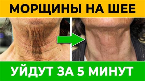 Как снизить количество складок на шее: советы для домашнего использования