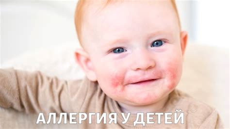Как снизить риск аллергии