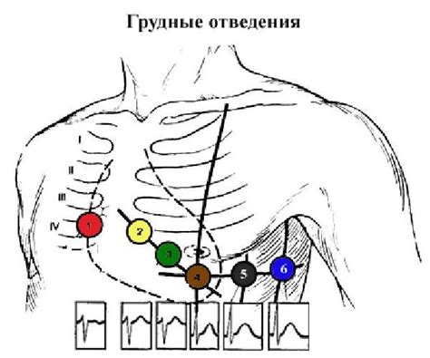 Как снять ЭКГ: подробная инструкция и рекомендации