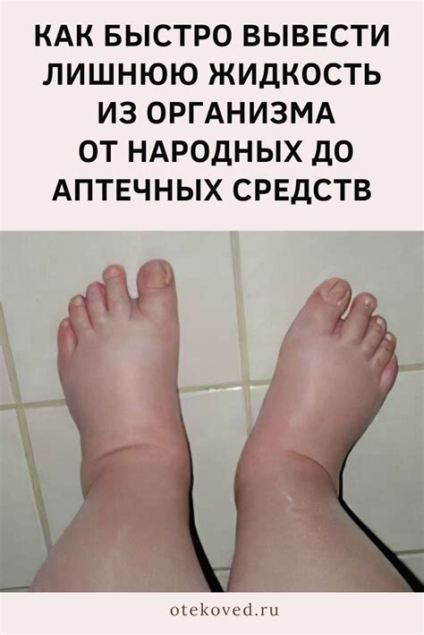 Как снять отеки с ног после работы