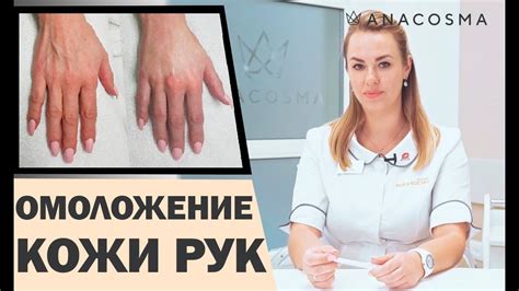 Как убрать точки на руках: простые домашние методы