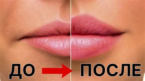 Как увеличить губы